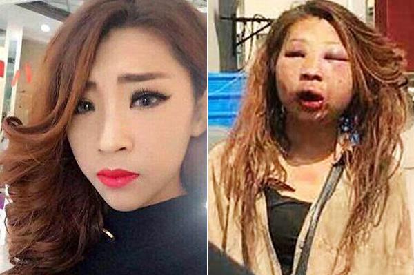 Cô gái trước và sau khi bị đánh ghen. Ảnh: Weibo
