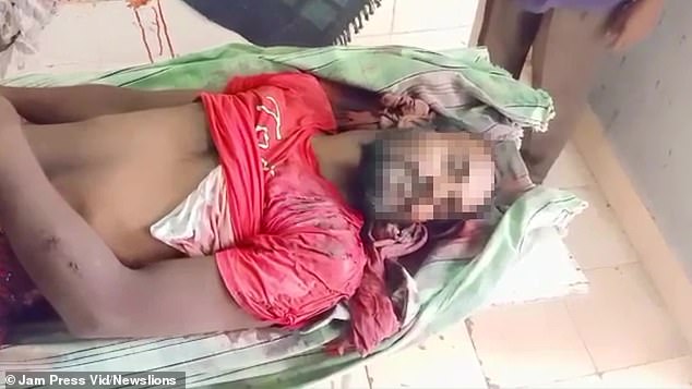 Nạn nhân Suresh, 35 tuổi, tử vong khi được đưa đến bệnh viện.