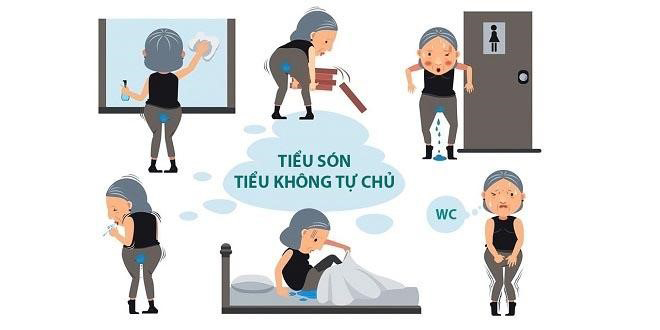 Ho, hắt hơi, cười lớn là “són tiểu” ướt quần, chị em làm thế nào để cải thiện? - 1