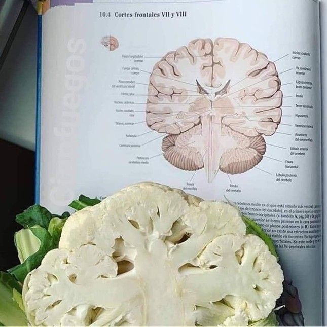 Cắt đôi một bông súp lơ, sinh viên Y đã có ngay thiết đồ ngang của não.