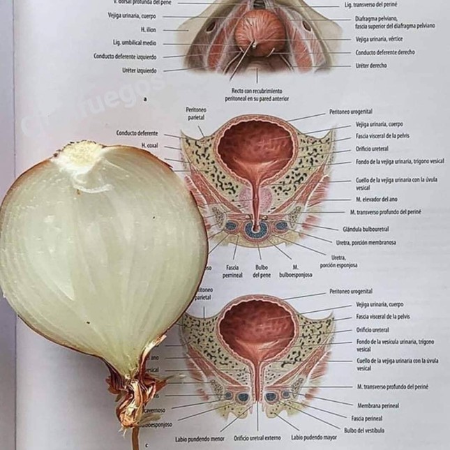 Người bình thường: Nửa quả hành tây thôi mà! Sinh viên Y: Này là bàng quang đúng "khum" quý zị?