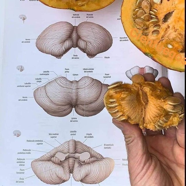 Nhìn thế nào cũng thấy tiểu não giông giống với... ruột bí!