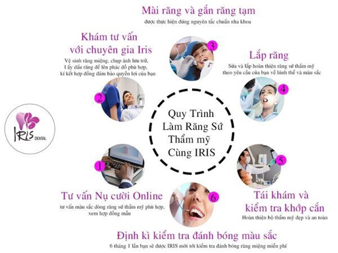 Nha khoa Iris cùng phương pháp làm răng thẩm mỹ hiện đại - 4