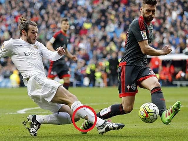 Chiếc tất rách của Bale