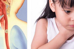 Sức khỏe đời sống - Chuyên gia tai mũi họng cảnh báo thói quen ăn uống dễ gặp dị vật đường ăn