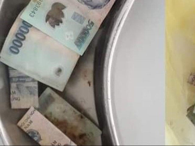 Bạn trẻ - Cuộc sống - Hy hữu người phụ nữ nuốt 12,5 triệu đồng tiền polyme vào bụng