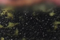 Sức khỏe đời sống - Chàng trai 28 tuổi có tới 485 viên sỏi mật vì thói quen này trong dịp Tết