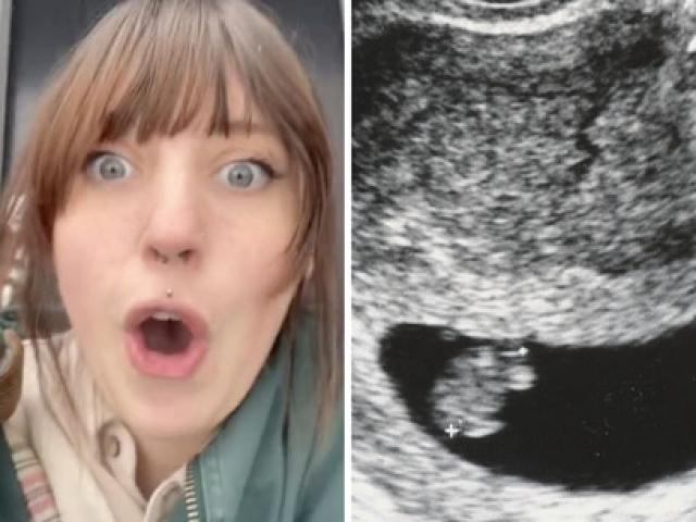 Bạn trẻ - Cuộc sống - Người phụ nữ nghĩ mình mang thai nhưng kết quả siêu âm tiết lộ điều gây sốc nặng