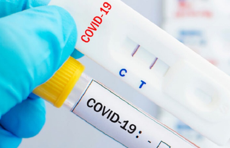 Đại diện Công ty CP Y tế Đức Minh cho biết doanh nghiệp chỉ phân phối một phần nhỏ số bộ test Covid-19 nhập khẩu trong 2 năm qua