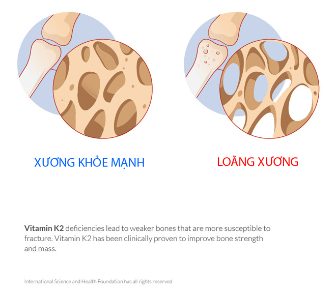 Không chỉ giúp trẻ cải thiện chiều cao vượt trội, đây là 3 lợi ích hiếm có khiến bạn phải bổ sung ngay vitamin K2 cho con! - 2