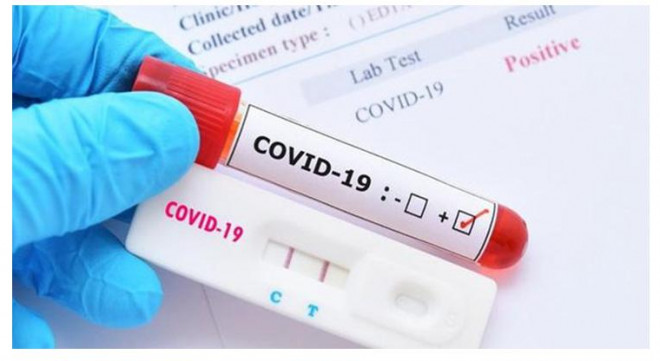 Thời điểm nào nên xét nghiệm COVID-19 sau khi tiếp xúc F0 để có kết quả chính xác nhất? - 2
