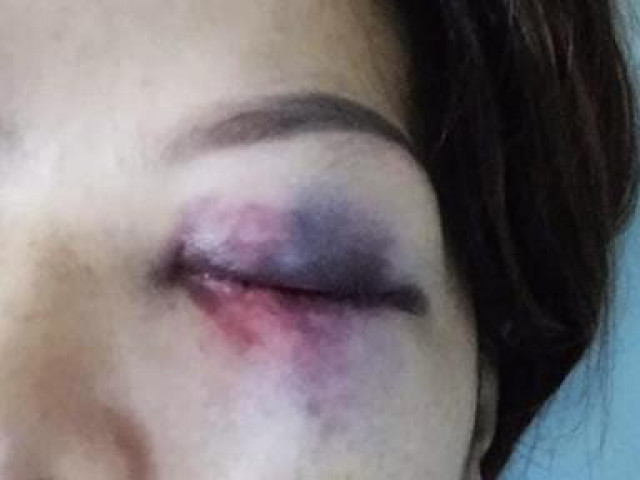 Pháp luật - Cuộc sống "địa ngục" của người vợ bị chồng cũ hành hung