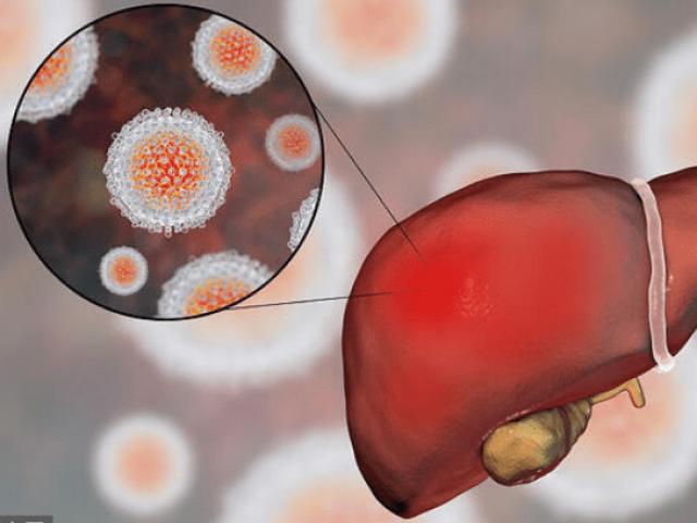 Ẩm thực - 5 loại thực phẩm là "thần hộ mệnh" của gan, nên ăn thường xuyên