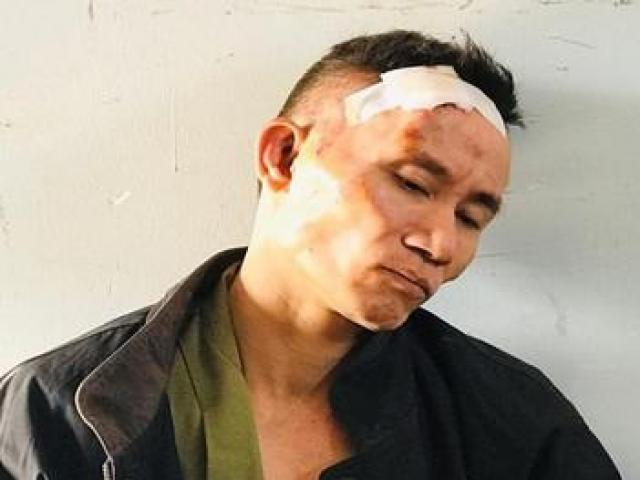 Pháp luật - Kẻ bị truy nã đấu súng với công an, ôm lựu đạn "mở đường máu" hầu tòa