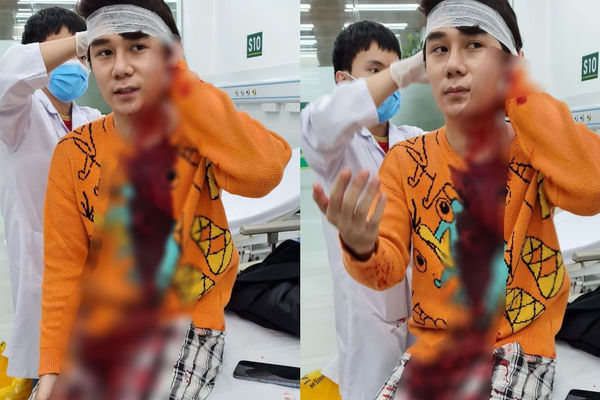 Diễn viên Ngô Sỹ Lâm nhập viện điều trị