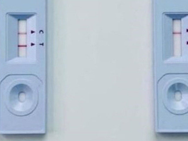 Sức khỏe đời sống - Cách phân biệt "dương tính giả" khi tự làm test nhanh COVID-19 tại nhà