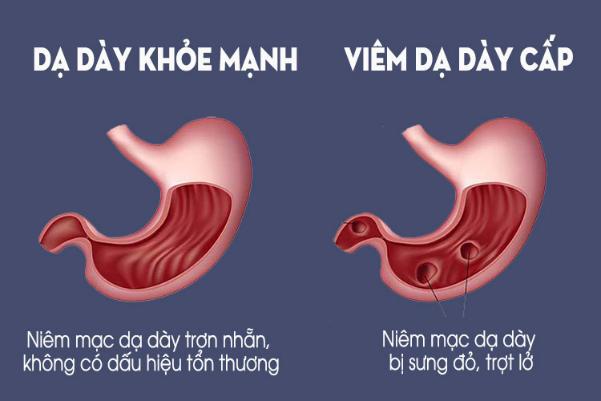 7 bài thuốc trị bệnh từ củ tỏi và những lưu ý khi dùng - 1