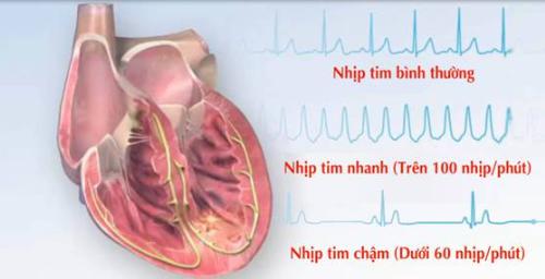Chuyên gia chỉ rõ những ảnh hưởng đến tim mạch sau nhiễm COVID-19 - 2
