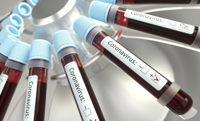Nhóm máu có liên quan tới nguy cơ mắc COVID-19 trầm trọng