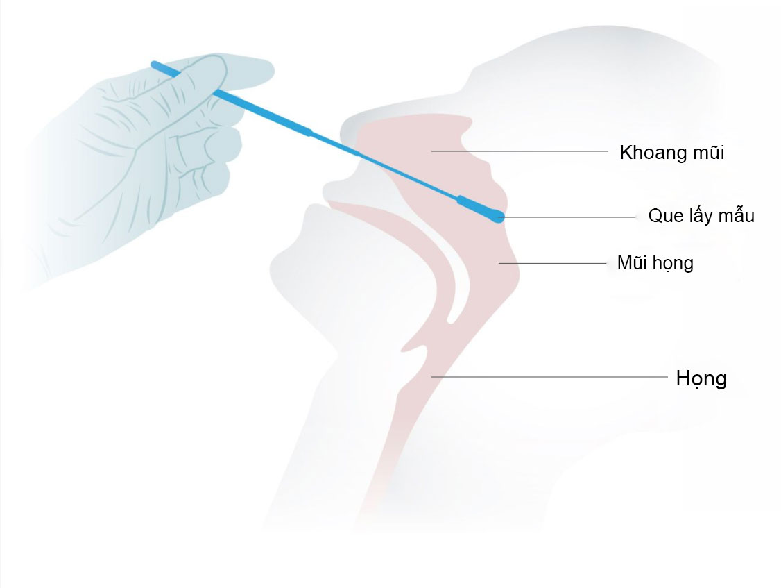 5 lưu ý khỉ sử dụng kit test nhanh COVID-19 tại nhà để cho ra kết quả chính xác nhất - 4