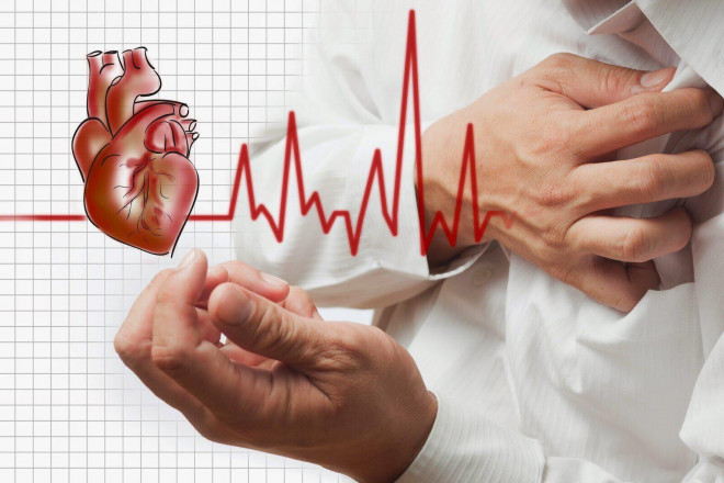 Cảnh giác với biến chứng tim mạch hậu COVID-19 - 4