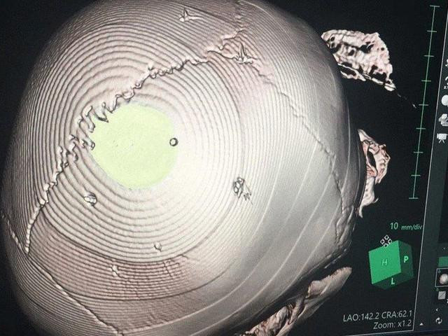 Pháp luật - Bé gái 3 tuổi bị bắn đinh vào đầu tử vong, kẻ thủ ác đối diện án tử hình?