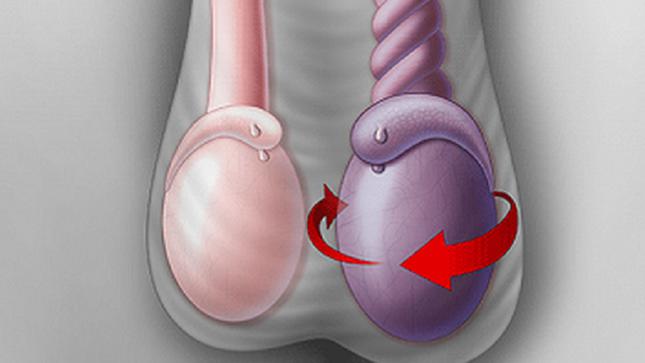 Two boys in a row had to have their testicles removed due to a disease that many parents subjectively ignored - 1