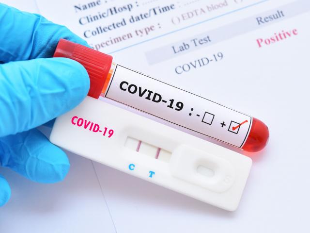 F0 khỏi bệnh cần làm gì để không bị tái nhiễm Covid-19?