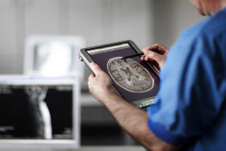 Sức khỏe đời sống - Ngay cả khi mắc COVID-19 nhẹ, não bộ cũng có sự tổn thương, chất xám bị giảm đáng kể