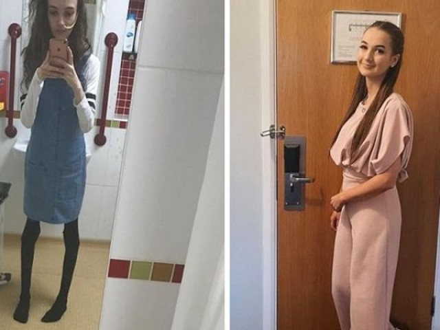 Bạn trẻ - Cuộc sống - Cô gái trông như “xác sống” vì ám ảnh chuyện ăn uống và màn lột xác gây ngỡ ngàng tột độ