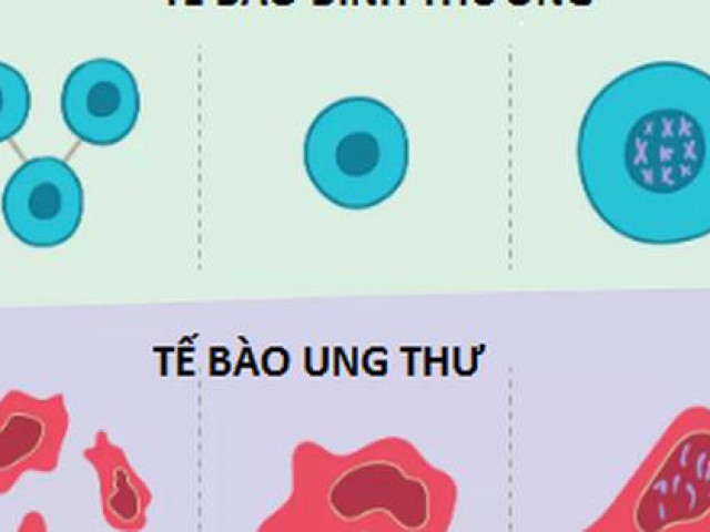 Sức khỏe đời sống - 4 loại trà hỗ trợ sức khỏe cho người bệnh ung thư