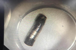 Sức khỏe đời sống - Bé trai nuốt phải dị vật gây thủng dạ dày, thứ này không nên để trẻ chơi