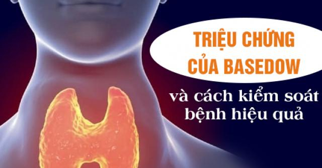 Triệu chứng của Basedow và cách kiểm soát bệnh hiệu quả