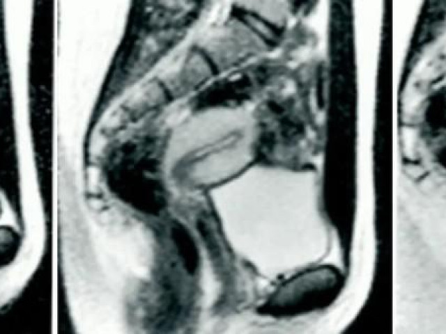 Sức khỏe đời sống - Làm "chuyện ấy" trong máy chụp cộng hưởng từ và những bức ảnh chấn động