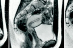 Sức khỏe đời sống - Làm "chuyện ấy" trong máy chụp cộng hưởng từ và những bức ảnh chấn động