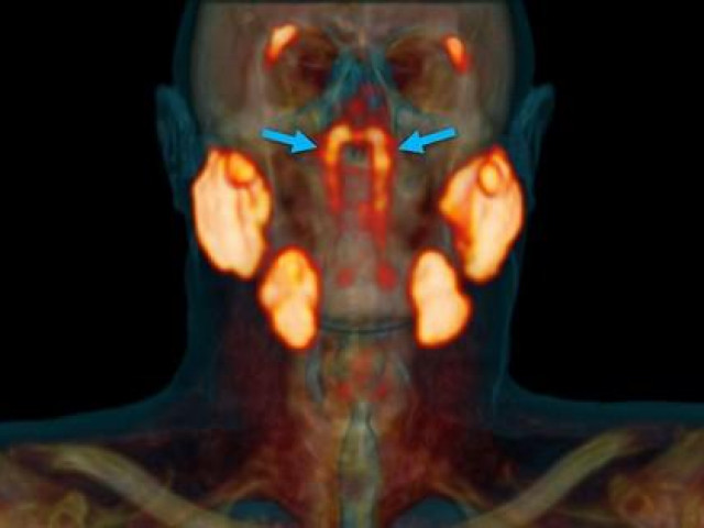 Phi thường - kỳ quặc - Nhóm bác sĩ Hà Lan khám phá cơ quan hoàn toàn mới trong cơ thể con người