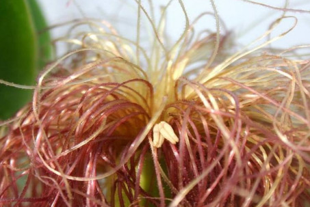 Nam giới bị viêm tuyến tiền liệt nhớ ăn 4 “món”, làm 2 "việc" này để...