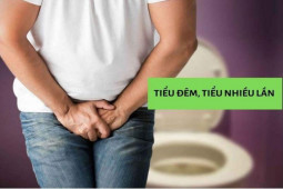 Sức khỏe đời sống - Bệnh lạ gây đi tiểu chục lần, đêm 4- 5 lần, khám không ra bệnh, “ngã ngửa” khi biết nguyên nhân!