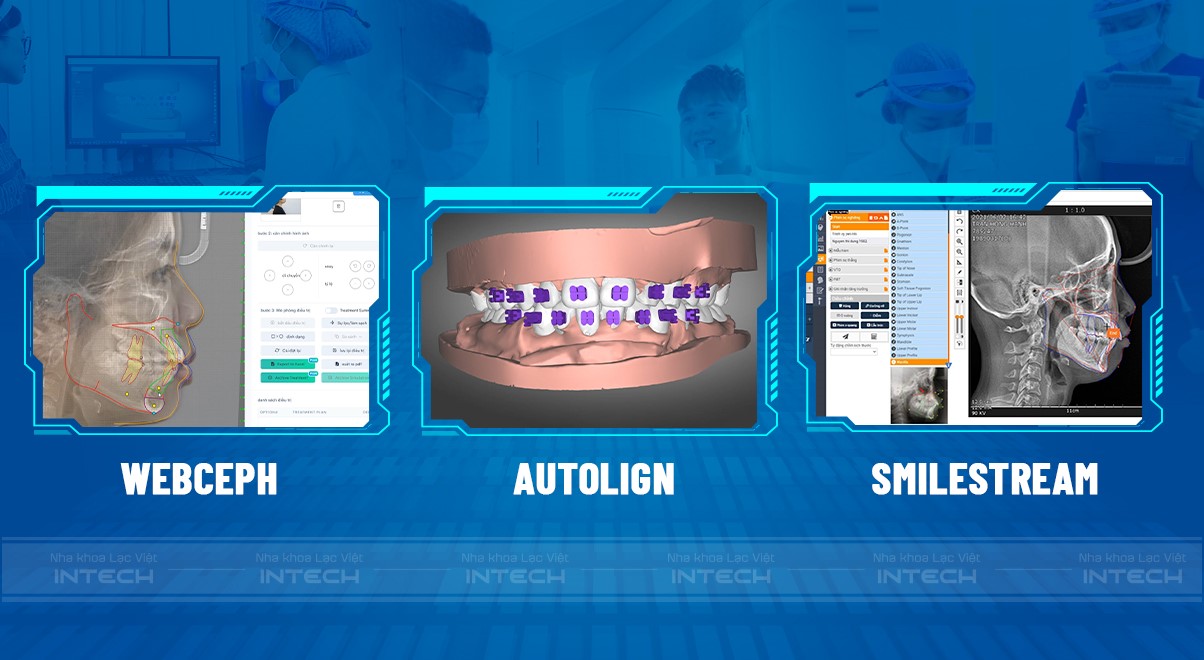 Công nghệ X-Matrix - Đột phá công nghệ chỉnh nha thế kỷ XXI