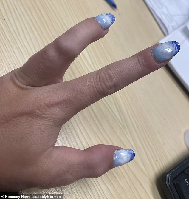 Cô bán cả những bàn tay đúc của mình và chúng thường được các bậc cha mẹ có con bị tình trạng tương tự mua để tăng thêm sự tự tin.