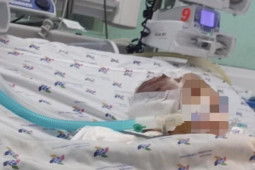 Tin tức trong ngày - Vụ bé 6 tháng tuổi bị đánh dập não: Nạn nhân thương tích 99%