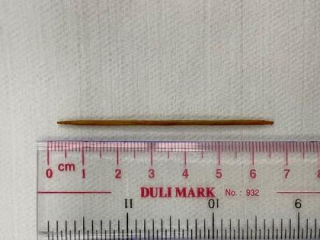 Sức khỏe đời sống - Người đàn ông bị thủng ruột non vì thói quen nhiều người Việt thường làm