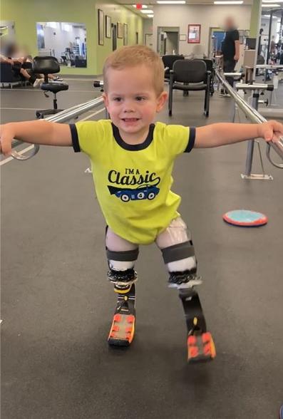 Video cảm động cậu trẻ cụt chân lần đầu tiên bước đi trên chân giả - 8