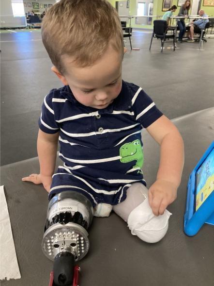 Video cảm động cậu trẻ cụt chân lần đầu tiên bước đi trên chân giả - 12