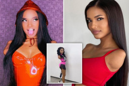 Bạn trẻ - Cuộc sống - Cô gái bị cụt ba chi vẫn là một người mẫu nóng bỏng