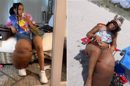 Bạn trẻ - Cuộc sống - Cô gái có chiếc chân "khổng lồ" vẫn tự tin làm mẫu