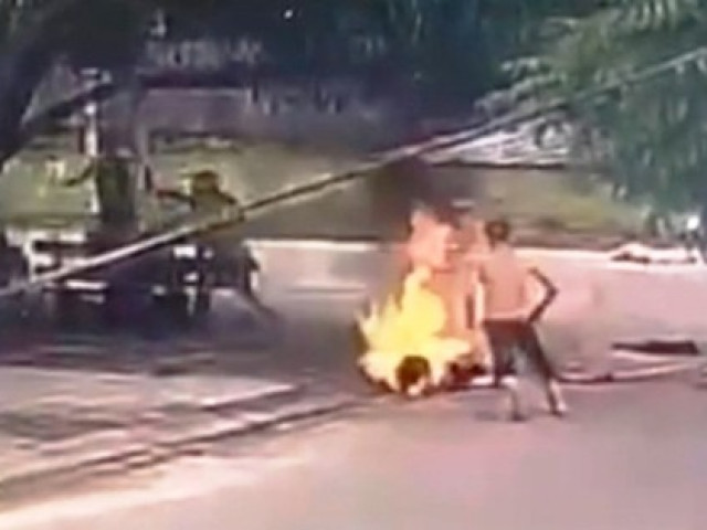 Cô gái bị tưới xăng đốt vì đánh ghen bị bỏng 30%