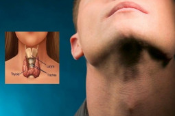 Sức khỏe đời sống - Cảnh giác với 10 dấu hiệu ung thư tuyến giáp