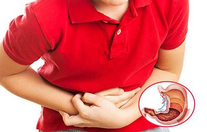 Nguyên nhân dẫn đến viêm loét dạ dày ở trẻ là do lối sống, thói quen sinh hoạt... Ảnh minh họa