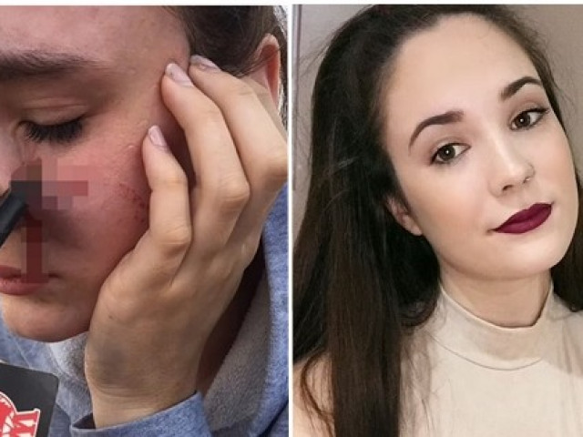 Bạn trẻ - Cuộc sống - Cô gái bị chìa khóa ô tô ghim vào mặt chỉ vì bắt trượt chùm chìa khóa bạn ném cho